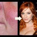 3 Ways Redheads Can Cover Redness or Rosacea with Makeup