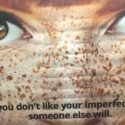 Match.com Ad Implies Freckles Are ‘Imperfections’