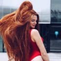 Redhead Woman Who Suffered from Alopecia Now Has Long Hair
