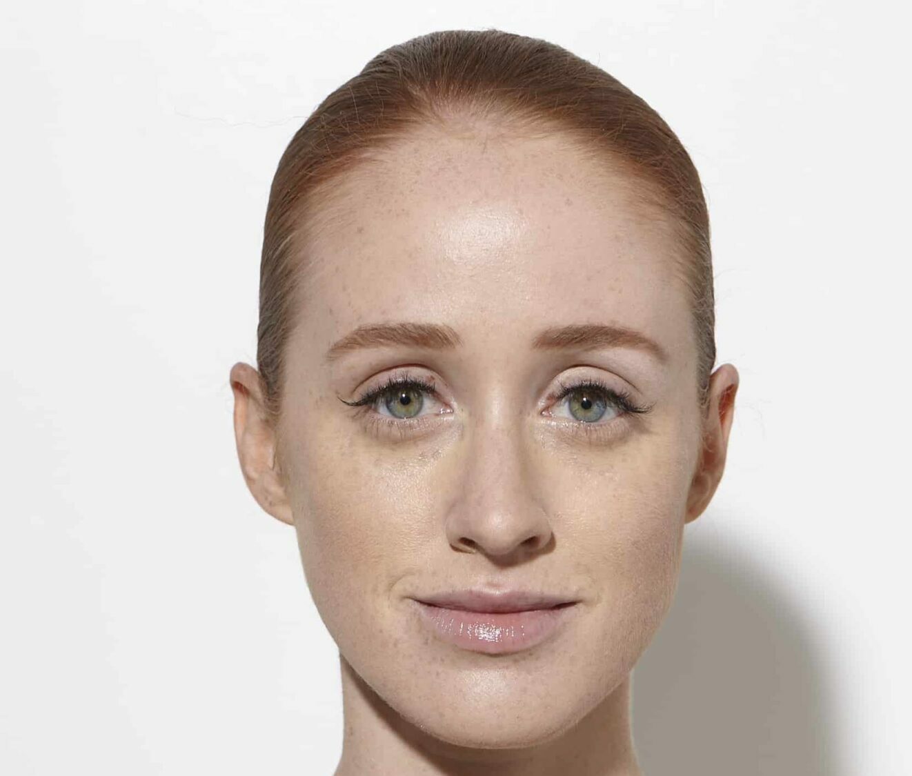 More Reasons We Love HydraFacials for Redheads, Learn More From An Expert