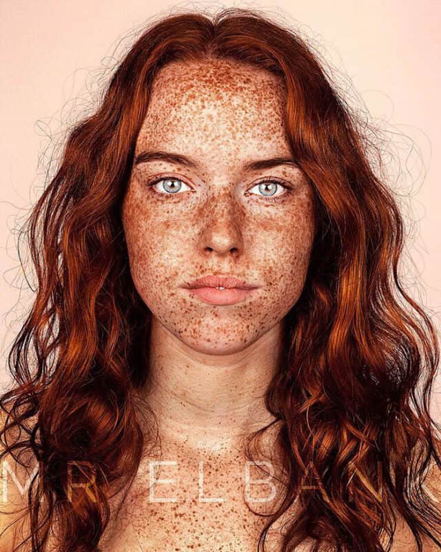 Freckles Portrait Photography Brock Elbank How To Be A Redhead