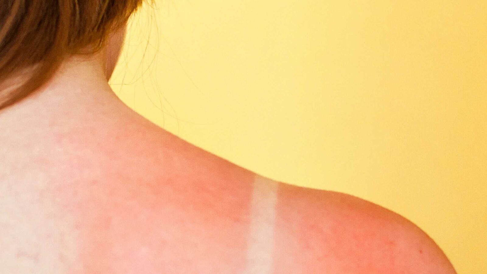 11 Tips If You’re Still Getting Sunburned After Applying Sunscreen