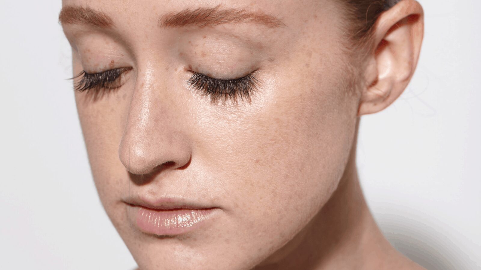 How Redheads Can Prevent Acne & Pimples: 4 Tips to Avoid Breakouts