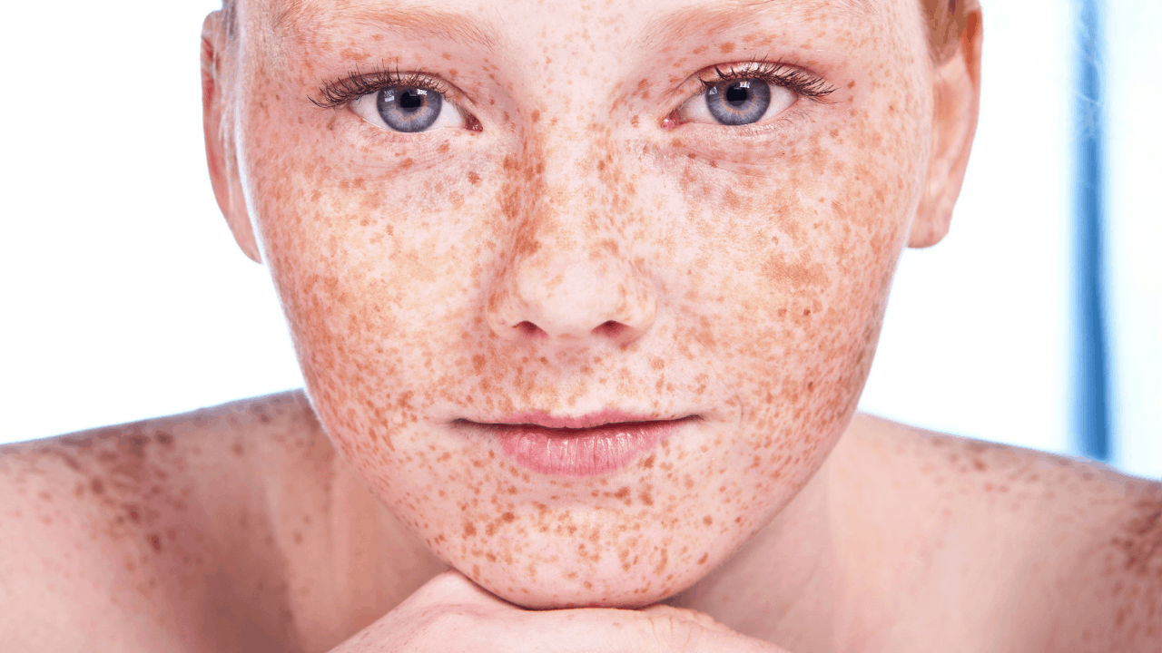 5 Makeup Tips Every Redhead With Freckles Should Know