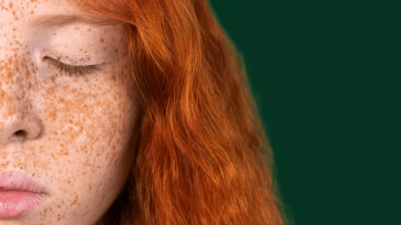 Redheads: What Are Your Freckles Trying to Tell You?