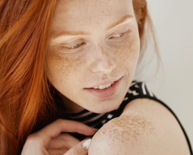 Top 4 Reasons to Love & Celebrate Your Beautiful Freckles