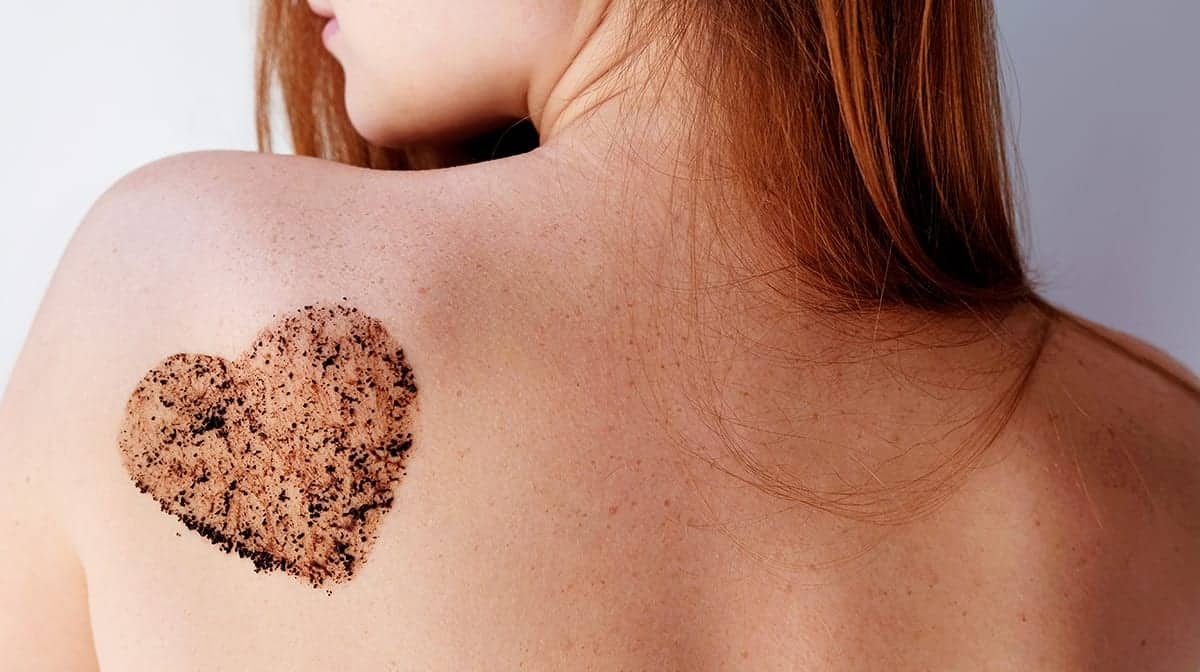 How Redheads Can Get Rid of Back Acne