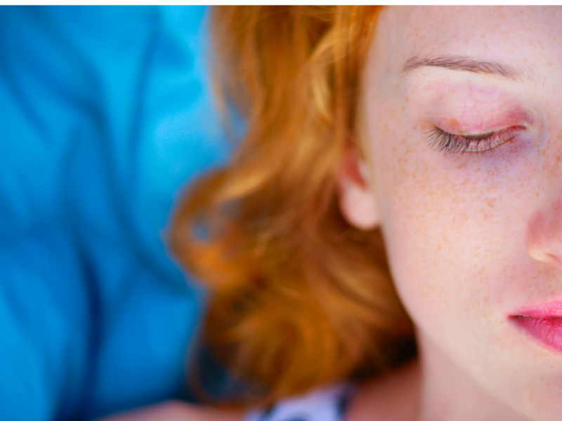 How Redheads Can Use Makeup to Cover Blue Veins and Dark Circles
