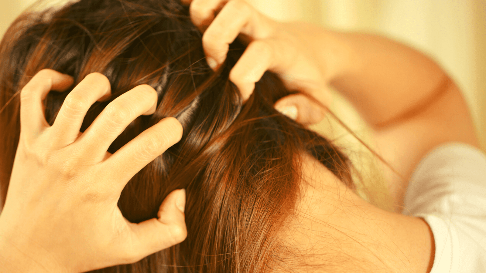 5 Best Remedies for Redheads With A Dry Scalp