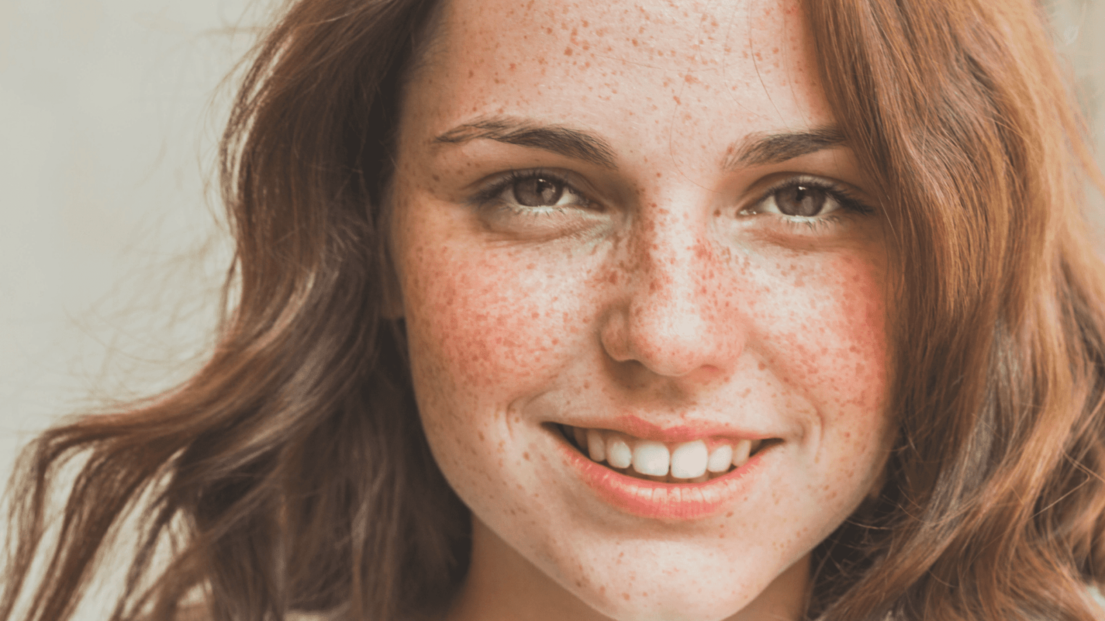 Why Do Freckles Fade As Redheads Age? We Have The Answers