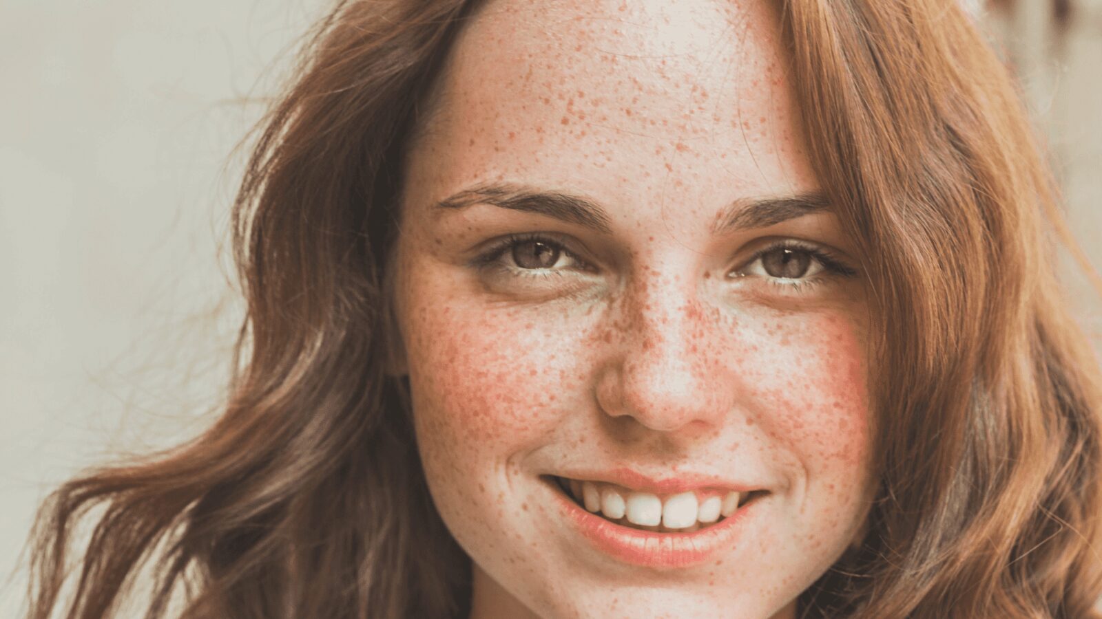 How to Get Freckles Without Damaging Your Redhead Skin