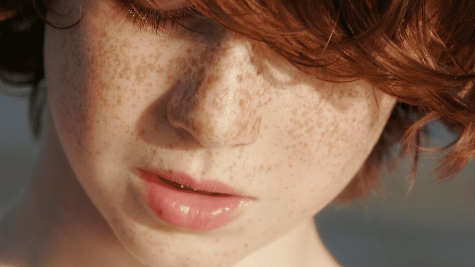 Dark Spots Can Get Worse During The Winter Months: How Redheads Can Stop It