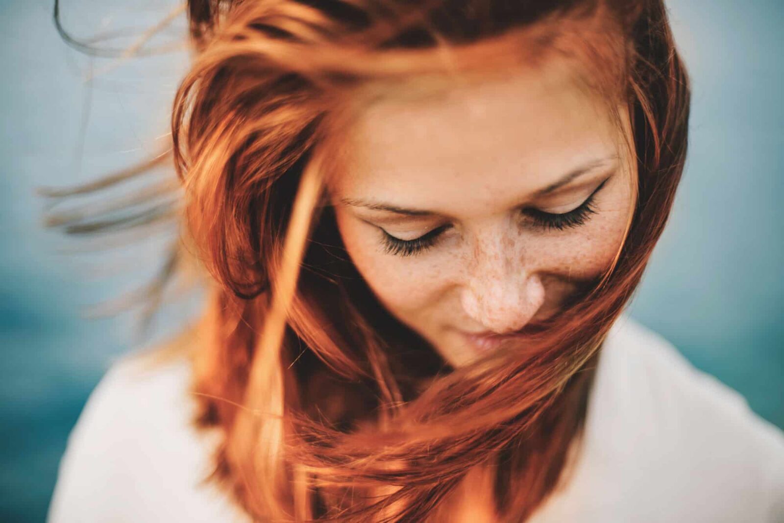 How Redheads Can Get Rid of Hairline Acne