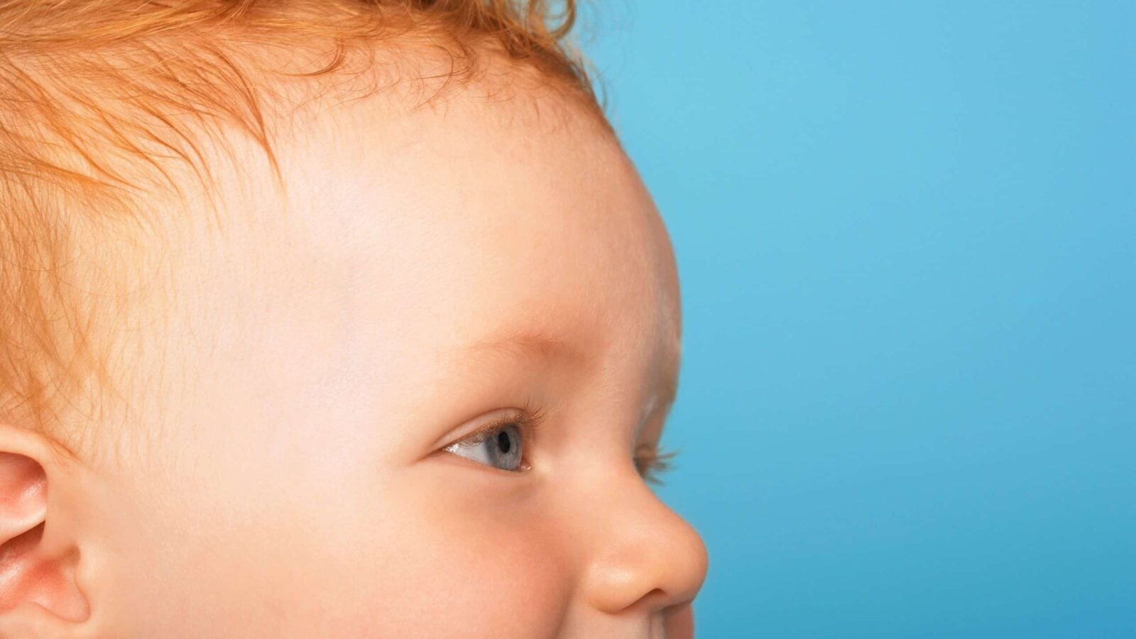 How To Eliminate Eczema for Redhead Babies + Toddlers