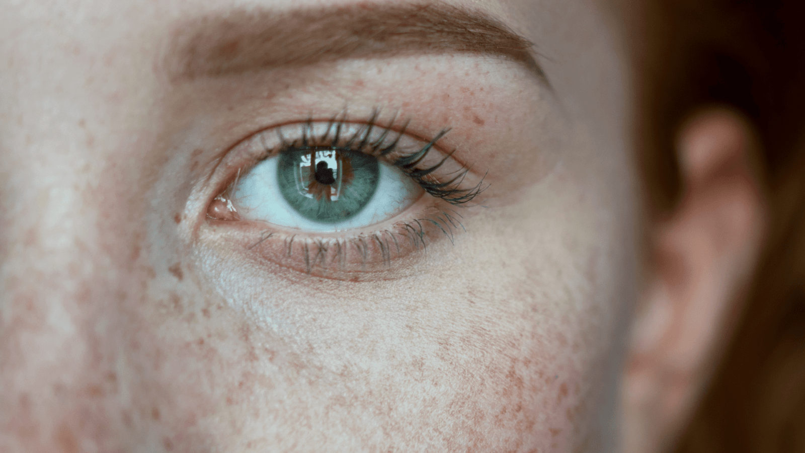 5 Freckle Facts