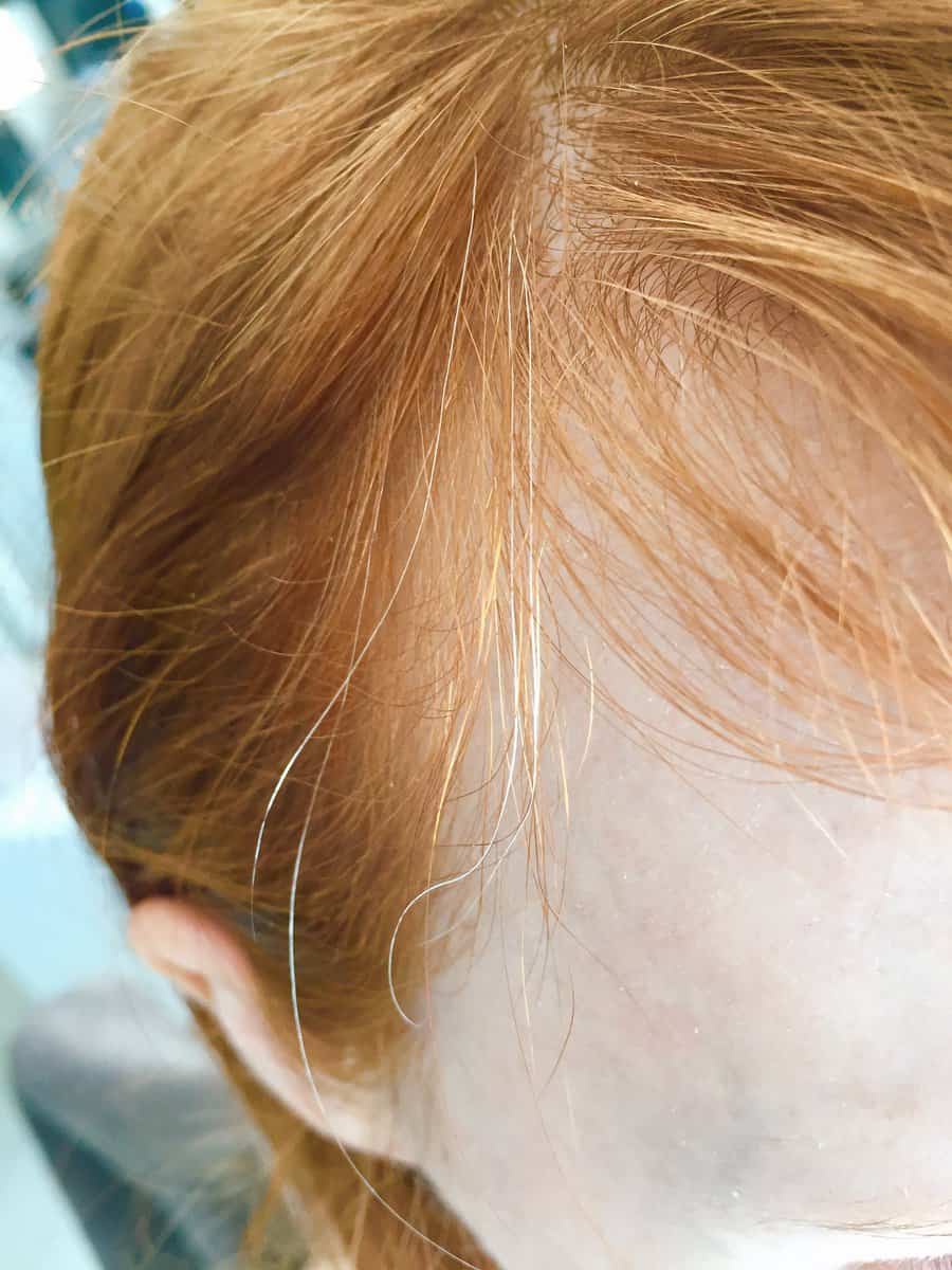 It's True: Stress Does Turn Hair Gray (And Redheads, It's Reversible)