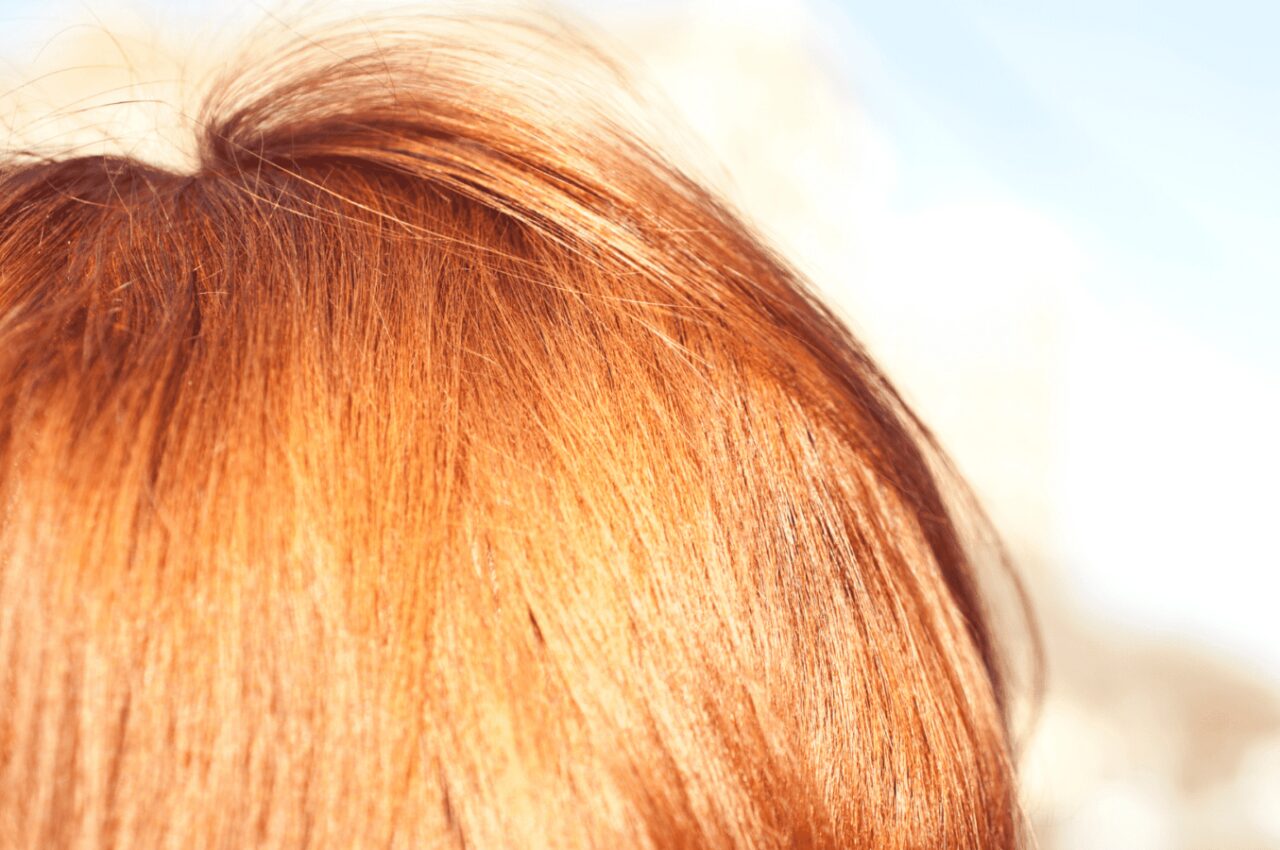 5 Ways Redheads Can Heal a Dry Flaky Scalp — How to be a Redhead - Redhead  Makeup