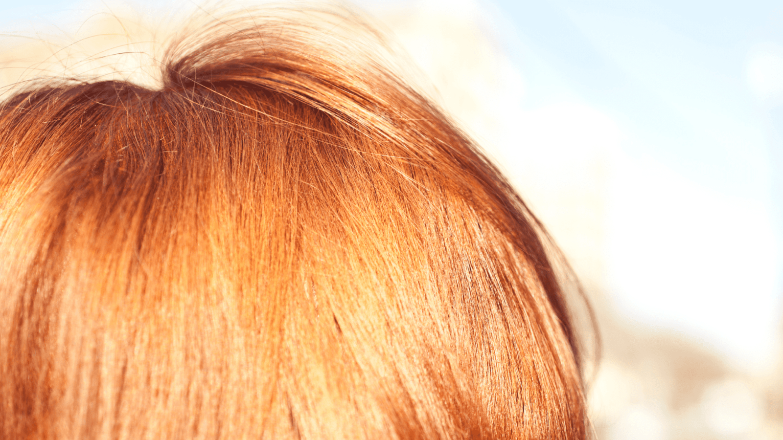 5 Ways Redheads Can Heal a Dry Flaky Scalp