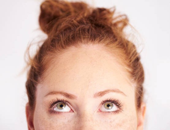 Redhead With Acne? What Pimples Really Mean, According to Science