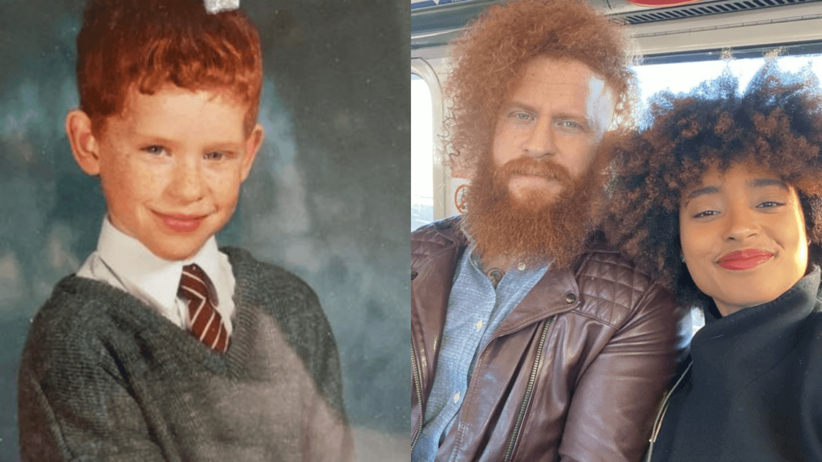 How It Was For This Redhead Man To Grow Up With Red Hair