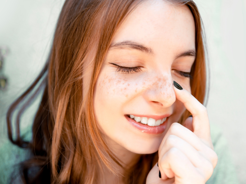 5 Facts About Freckles You Probably Didn’t Know