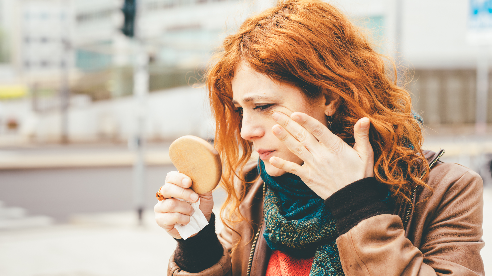 5 Eczema Tips For Sensitive-Skinned Redheads This Winter
