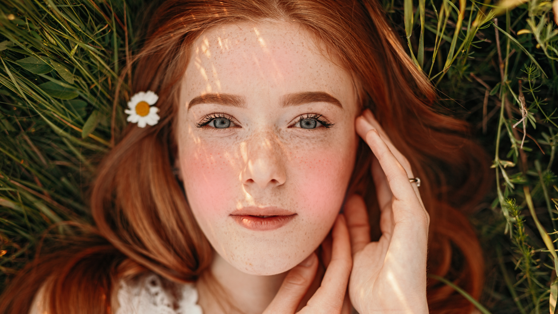 How Redheads Can Deal With Facial Redness This Spring