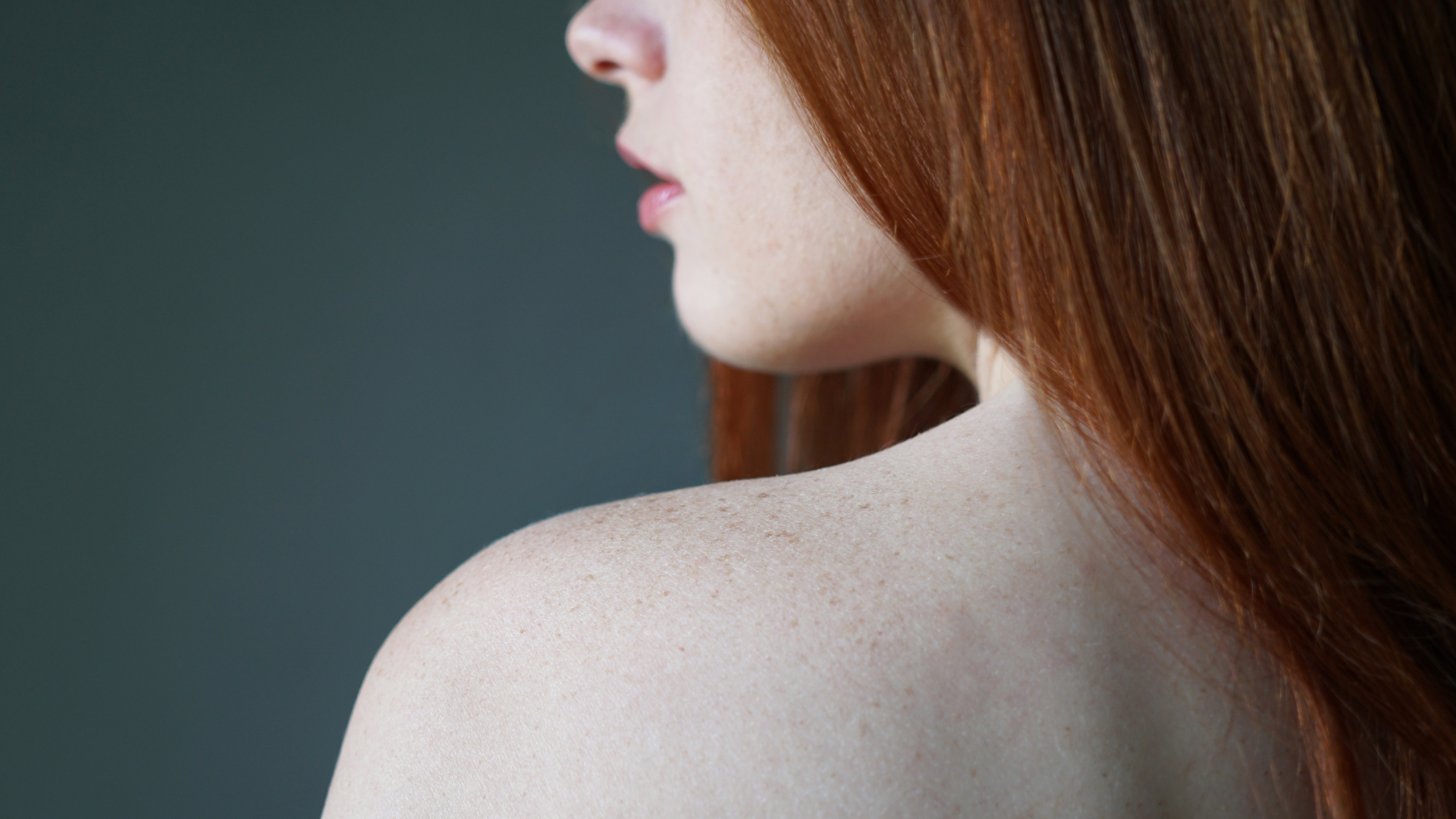 Where Do Redheads Fall on the Fitzpatrick Skin Type Scale?