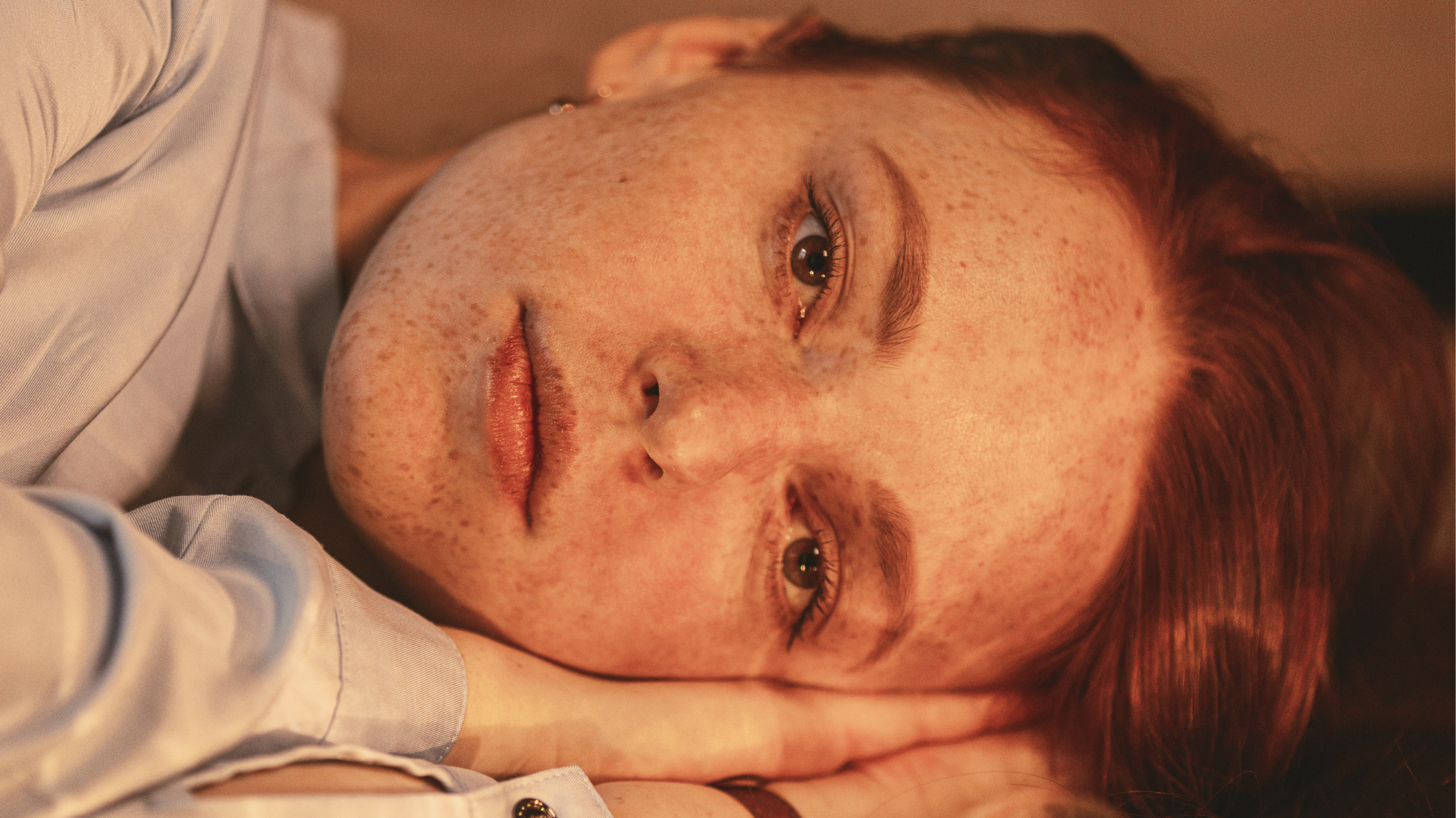 Freckles & Moles: This Is When Redheads Should Get Checked By A Dermatologist