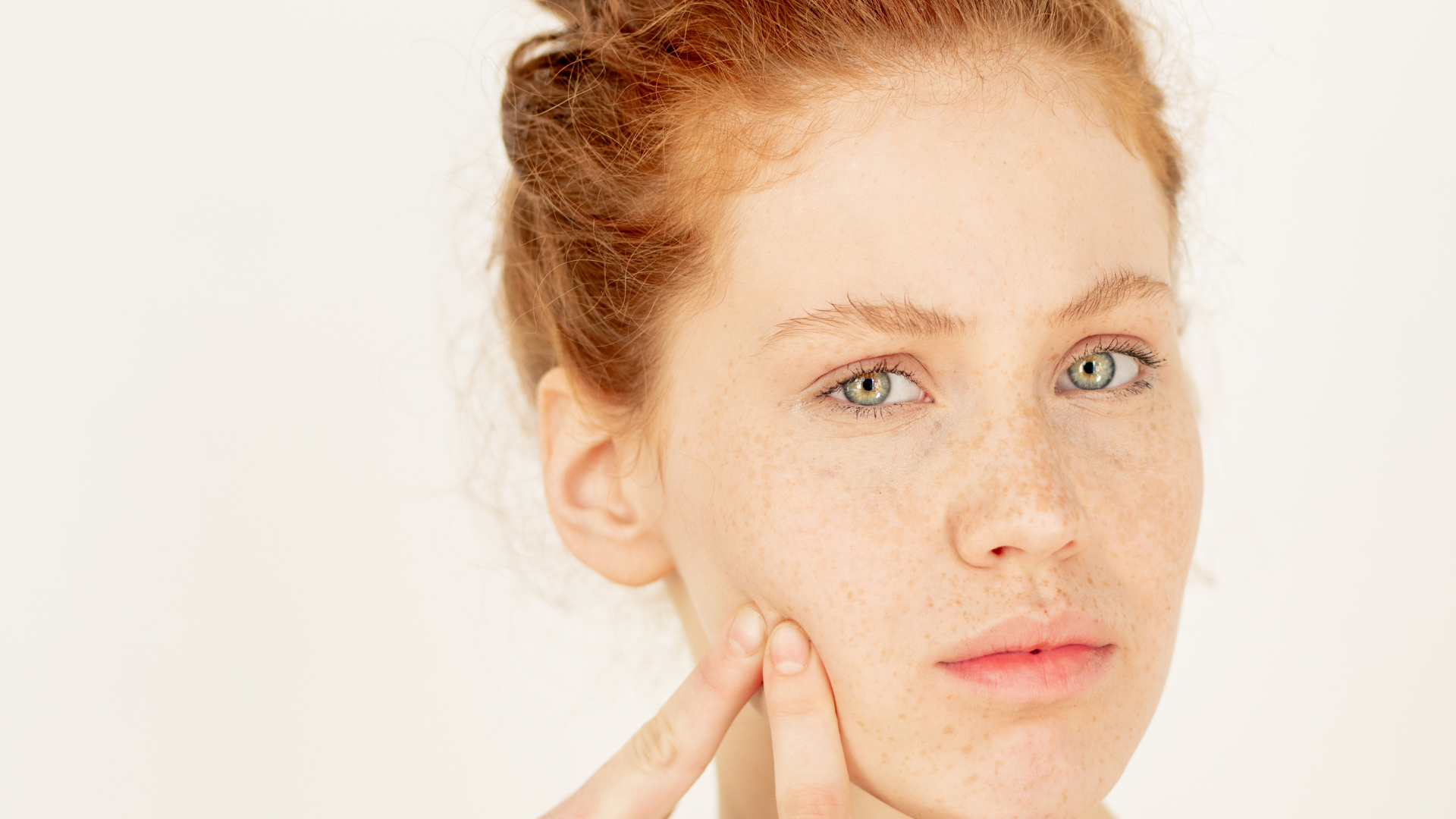 What Redheads Can Do If SPF Is Causing Breakouts