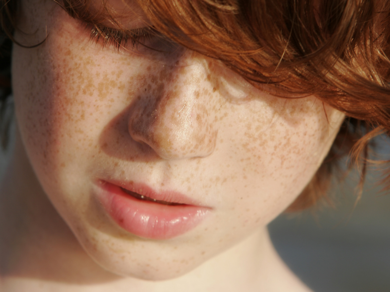 8 Ways Redheads Can Protect Their Freckles This Summer