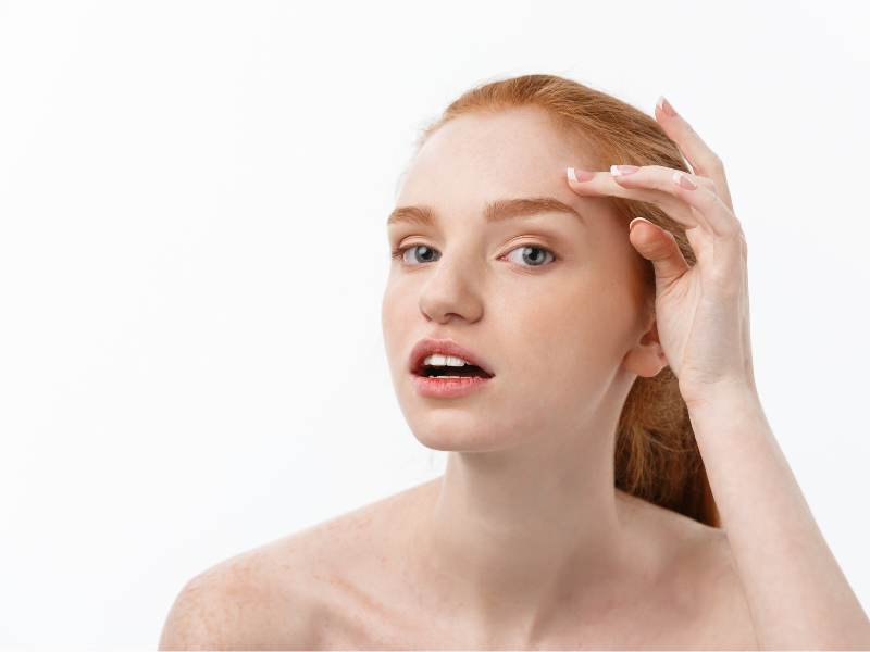 Can Fake Tan Cause Acne and Breakouts for Redheads?
