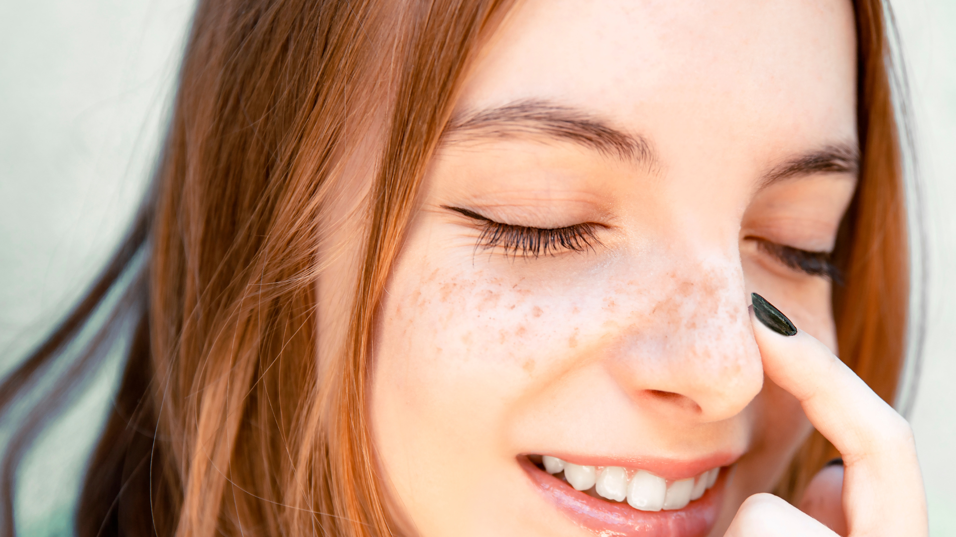 How Redheads Can Conceal or Get Rid of Hyperpigmentation