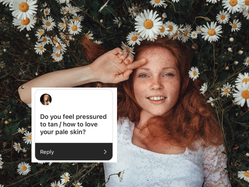 Ask a Redhead: Feeling Pressured To Tan And How To Embrace Your Skin