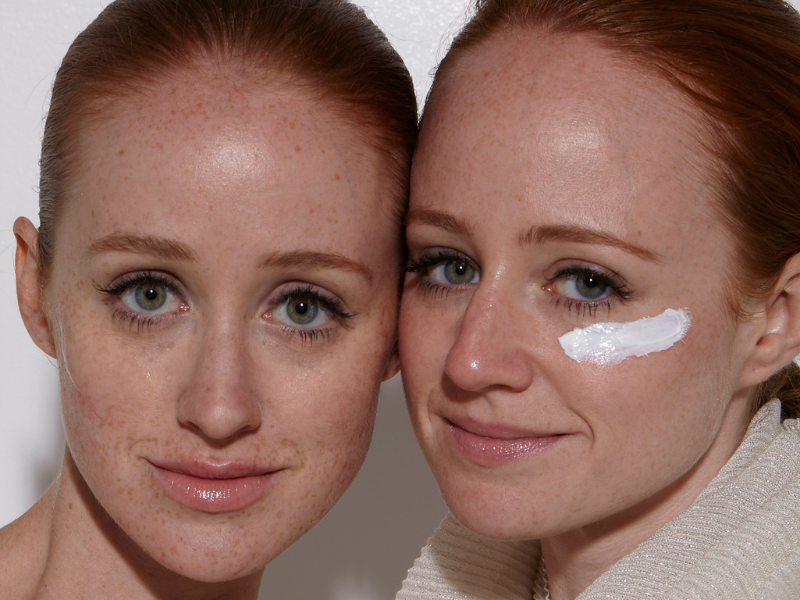 Why Redheads Should Avoid The SPF & Facial Oil Combo