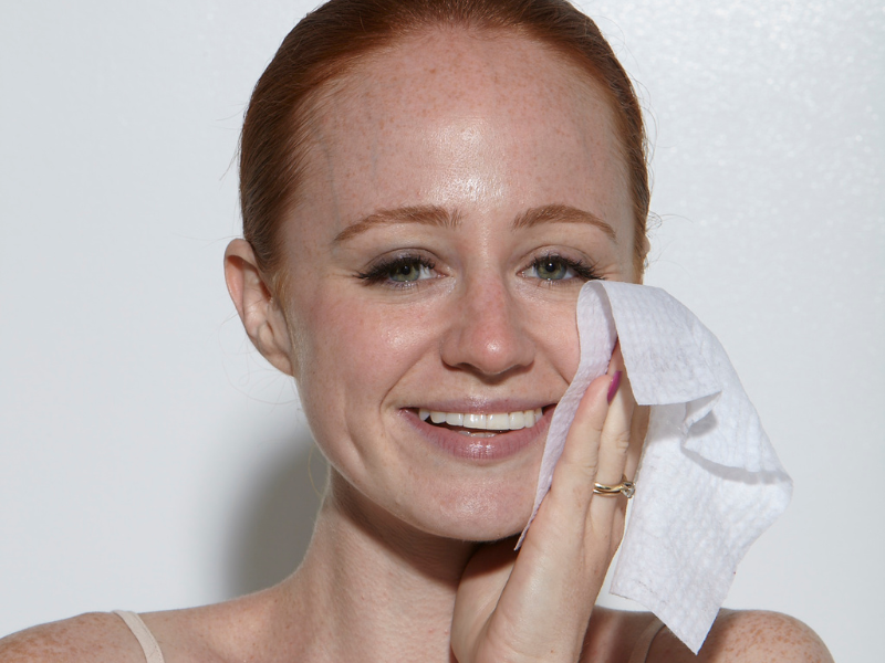 What To Do If You’re a Redhead With “Bad Skin” But Do Not Have Breakouts