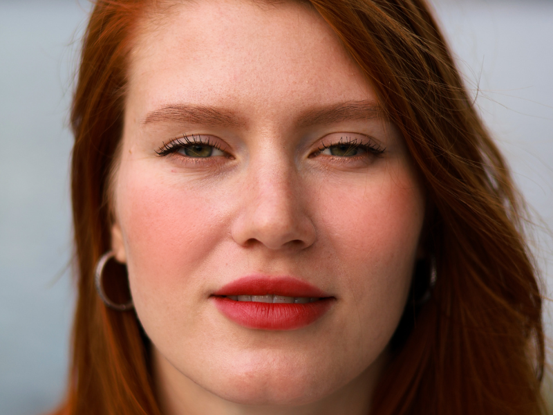 Are You A Redhead Who Always Has Red Cheeks? Here’s Why!